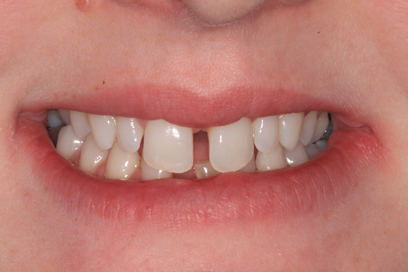 Before