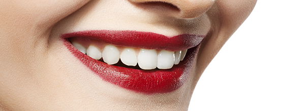 Mi Smile