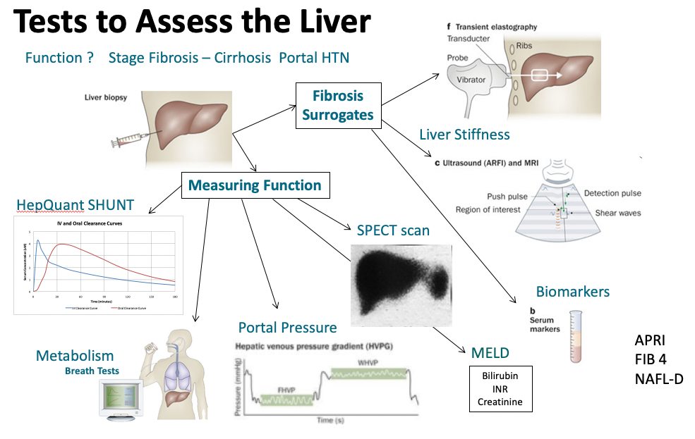 Screening for Liver Disease Dr. Gish