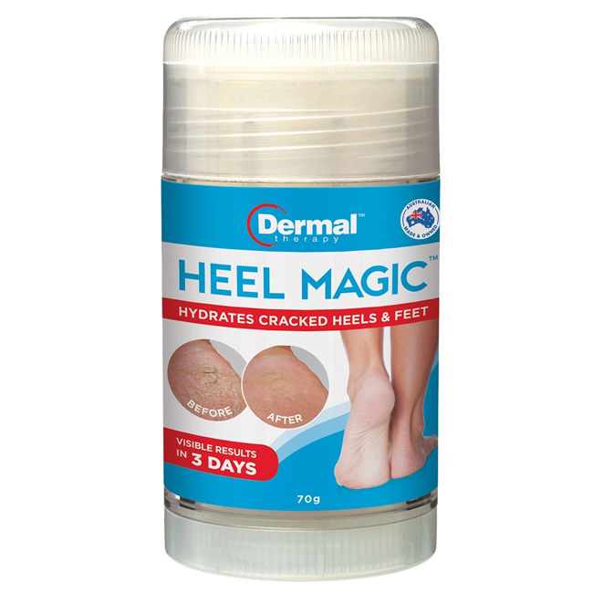 Heel Magic